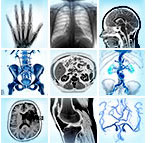 xrays